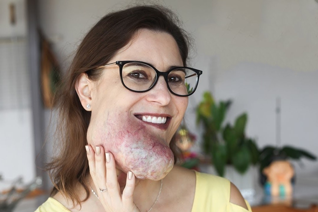 Cuoc song cua nguoi phu nu co khoi u tren mat hinh anh