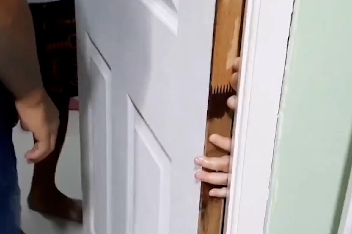 Be gai 6 tuoi o Thai Lan bi ket ngon tay vao khe cua hinh anh