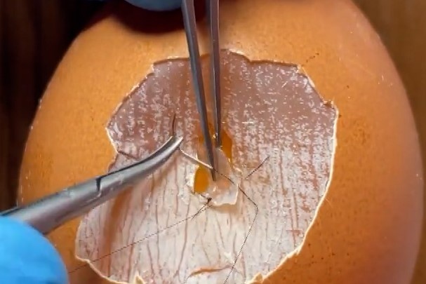 Nam sinh nguoi Nga thuc hanh phau thuat trai cay hinh anh