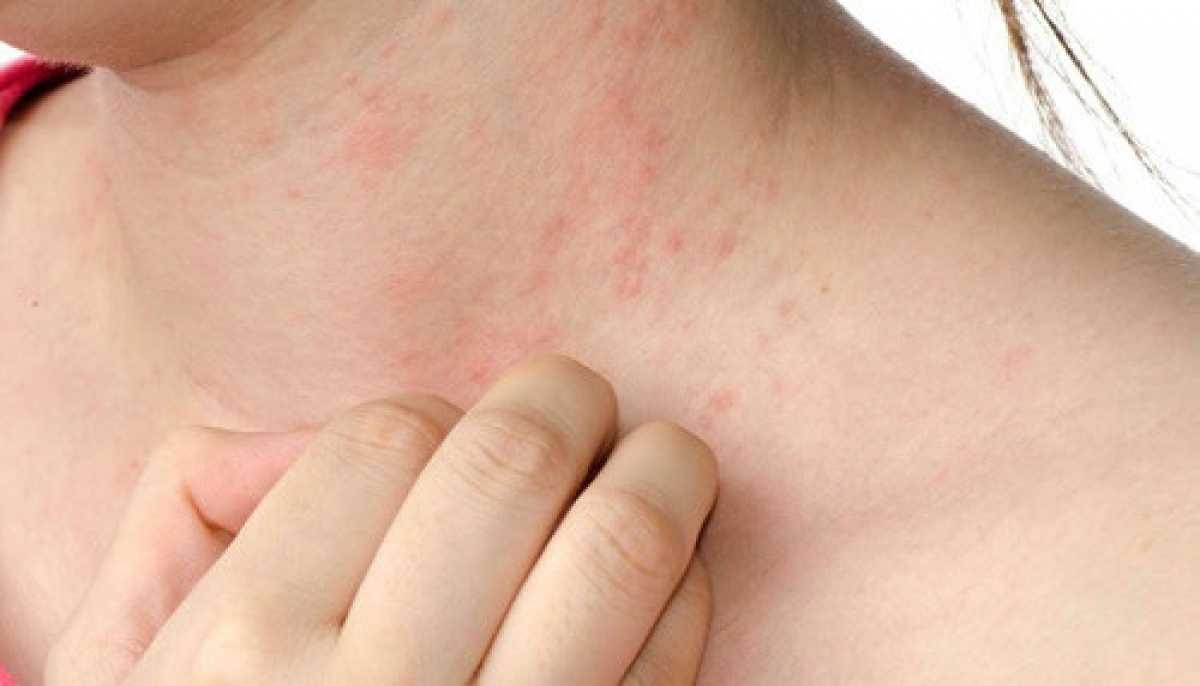 Con nguoi co the tiep xuc 100.000 loai doc to moi ngay hinh anh