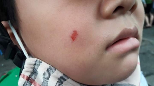 Gia cua cai tat hinh anh