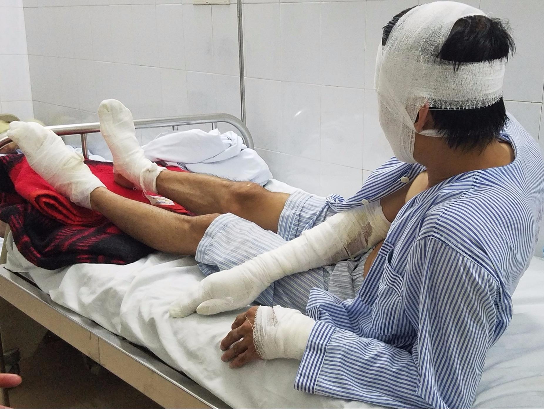 Nan nhan vu no bot dien chay nhu ngon duoc hinh anh