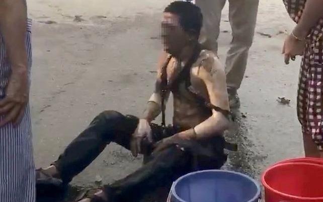 Mot nan nhan vu no bot dien qua doi hinh anh