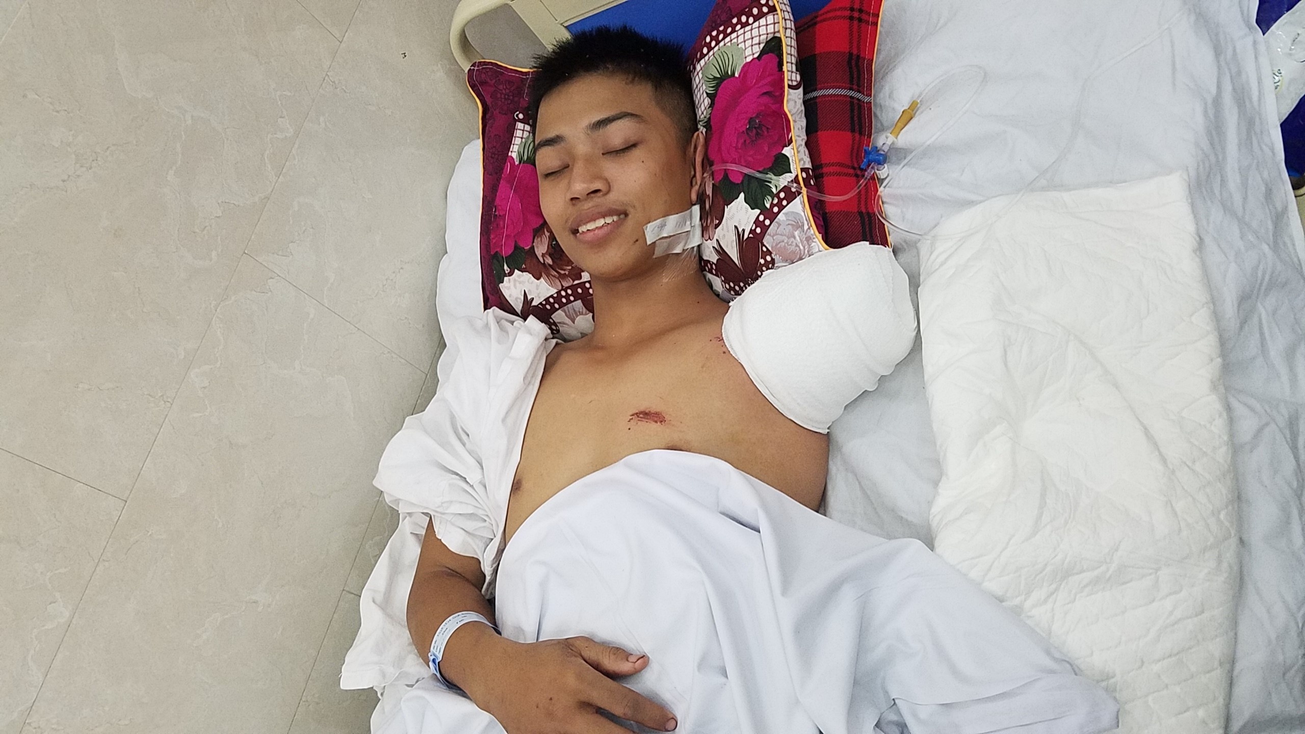 chàng trai mất tay vì cứu bạn ảnh 1 chang trai mat tay vi cuu ban anh 1
