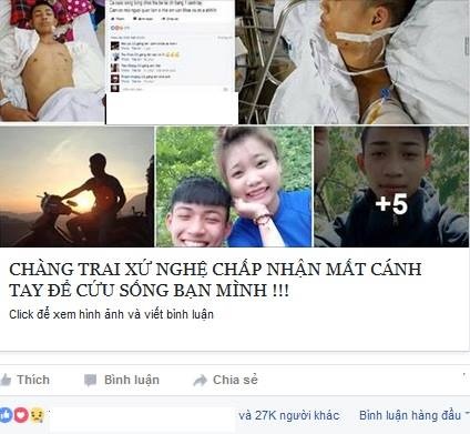 chàng trai mất tay vì cứu bạn ảnh 2 chang trai mat tay vi cuu ban anh 2