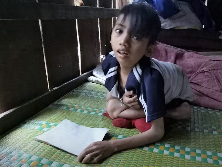 cậu bé không thể đứng thẳng ảnh 1 cau be khong the dung thang anh 1