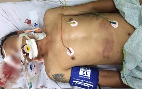 Tai nạn ô chợ dừa ảnh 1 Tai nan o cho dua anh 1