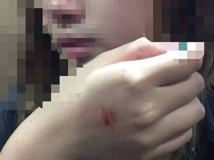 Nguoi dan ong sam so nu sinh trong thang may da trinh dien hinh anh