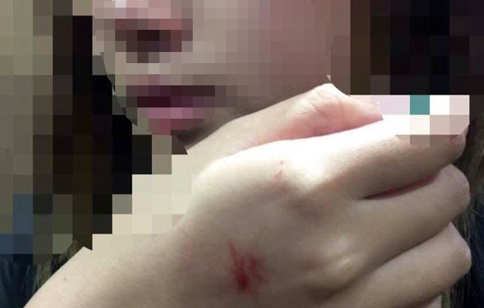 VKSND vao cuoc vu co gai bi sam so trong thang may hinh anh