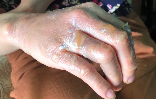 đoàn cưỡng chế bị ném bom xăng ảnh 1 doan cuong che bi nem bom xang anh 1