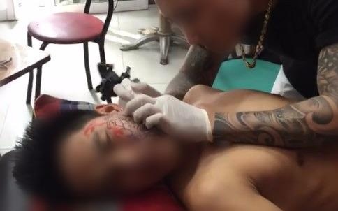 Chang trai xam hinh kin nua mat vi that tinh hinh anh