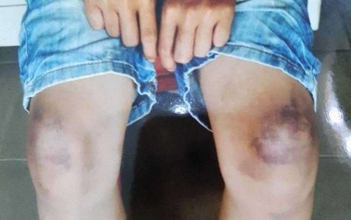 Cha va me ke bi to danh cau be 12 tuoi nhap vien hinh anh