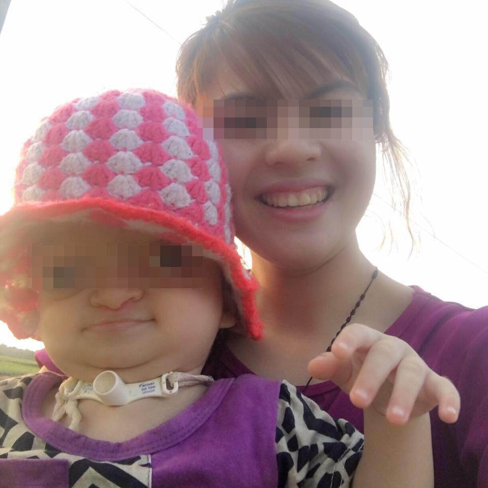 Mẹ xinh đẹp bên con dị tật ảnh 2 Me xinh dep ben con di tat anh 2