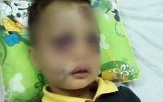 Dan mang keu goi giup do cau be ngheo bi nga tu san thuong hinh anh