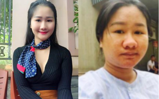 Tam su buon cua co gai xinh dep bong xau xi vi mang bau hinh anh