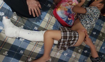 con gãy chân phụ huynh tố nhà trường ảnh 1 con gay chan phu huynh to nha truong anh 1