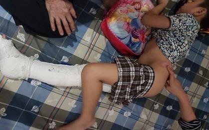 Hoc sinh gay chan: Phu huynh 'to', truong noi vo can hinh anh