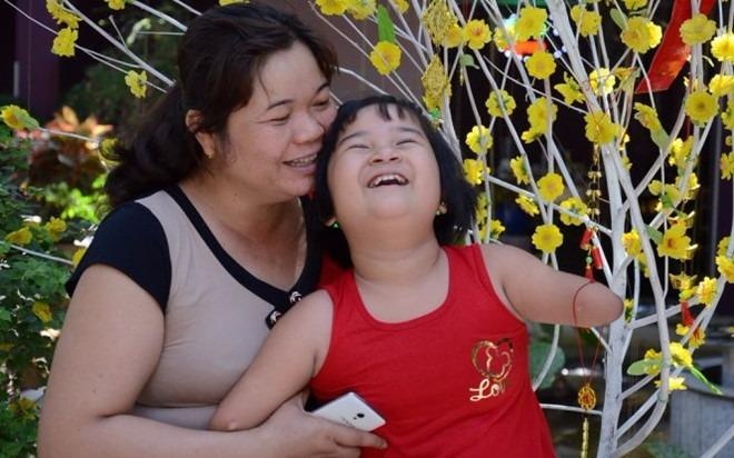 Nghi luc cua co be khong chan tay o Sai Gon hinh anh