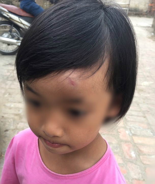 cô giáo ném dép vào đầu trẻ ảnh 1 co giao nem dep vao dau tre anh 1