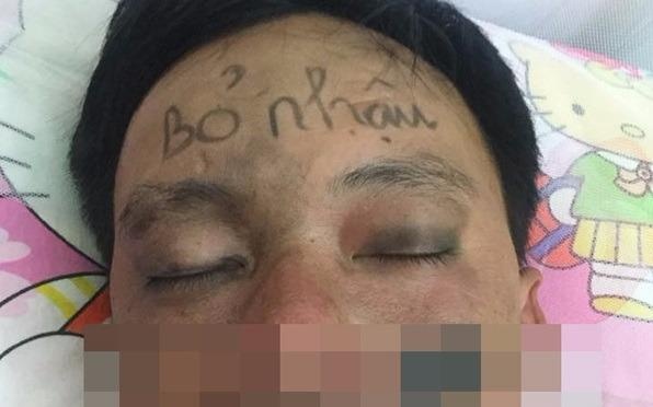 Nguoi vo ve chang chit len mat chong vi nhieu lan nhau say hinh anh