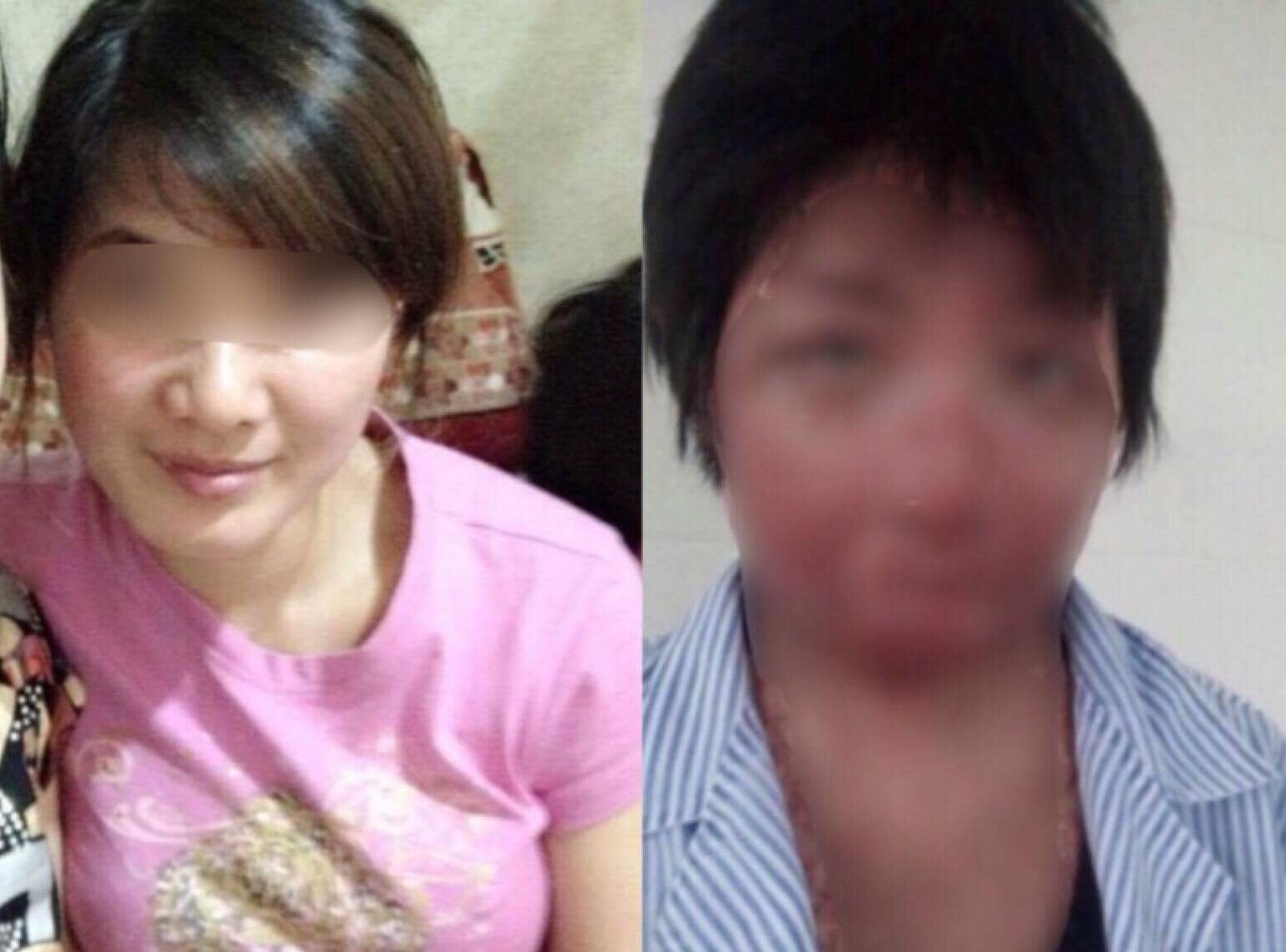 Guong mat 9X bien dang hoan toan sau khi bi chong tam xang thieu song hinh anh