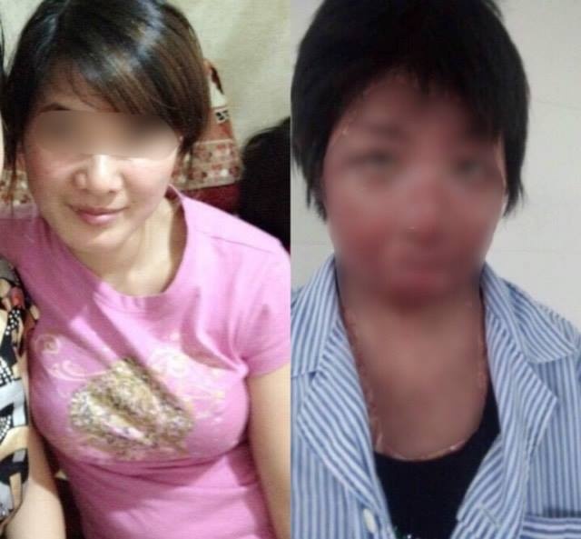 noi dau cua co gai bi chong dot anh 2