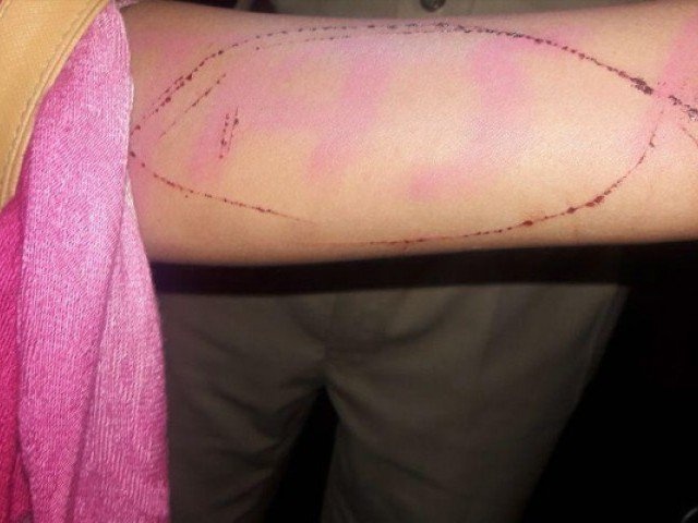 Tro choi nguy hiem 'Ca voi xanh': Quyet tam ngan chan tu dau hinh anh