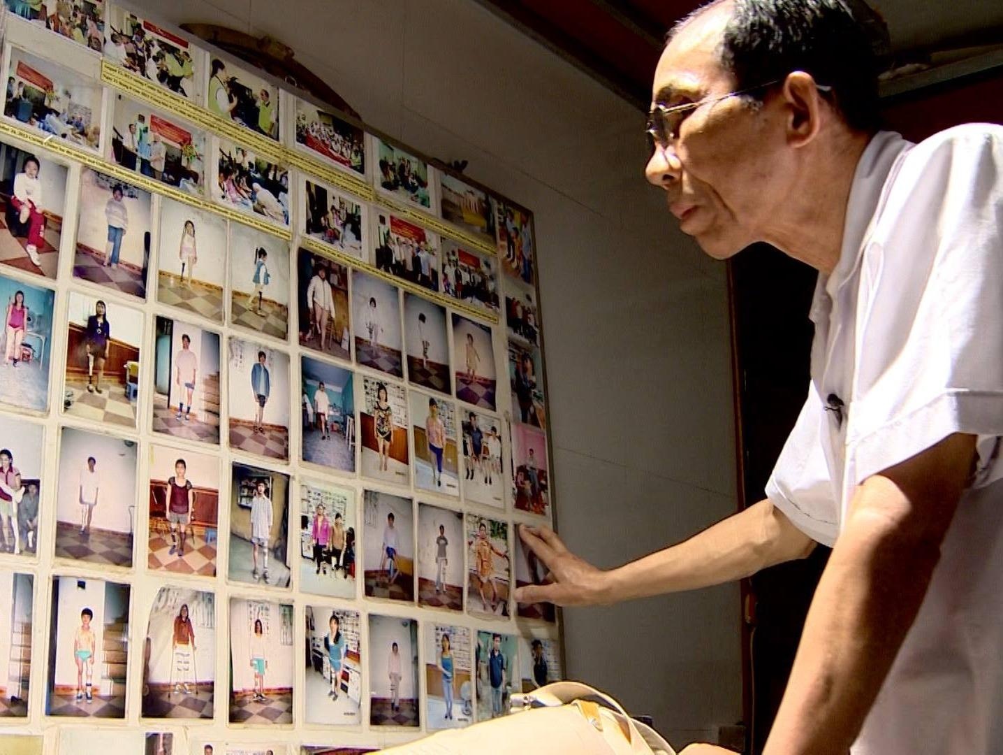 Cau chuyen bac si giau long nhan ai va nguoi phu nu mat mot chan hinh anh