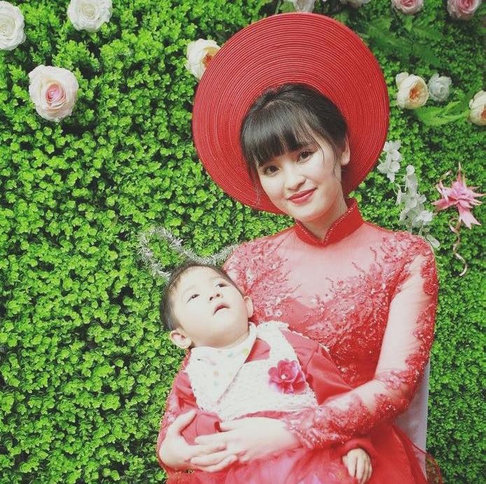 cô bé Lào Cai suy dinh dưỡng ảnh 1 co be Lao Cai suy dinh duong anh 1