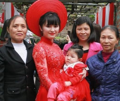 cô bé Lào Cai suy dinh dưỡng ảnh 2 co be Lao Cai suy dinh duong anh 2