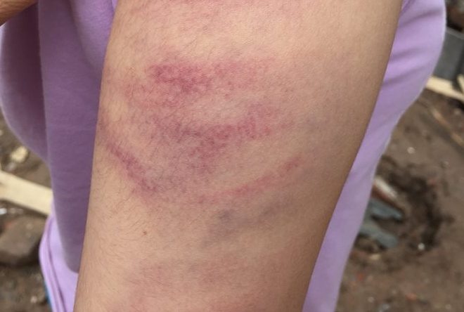 cô giáo đánh học sinh ảnh 1 co giao danh hoc sinh anh 1