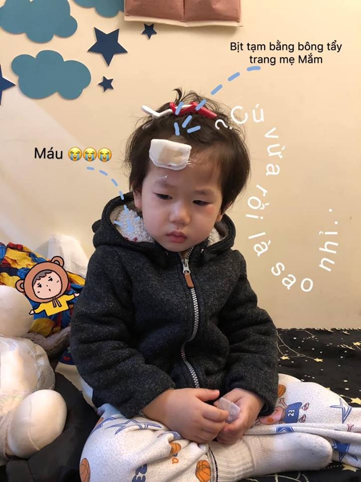 Xoài bị ngã Cam Đậu có tóc xoăn đón Tết ảnh 1 Xoai bi nga Cam Dau co toc xoan don Tet anh 1