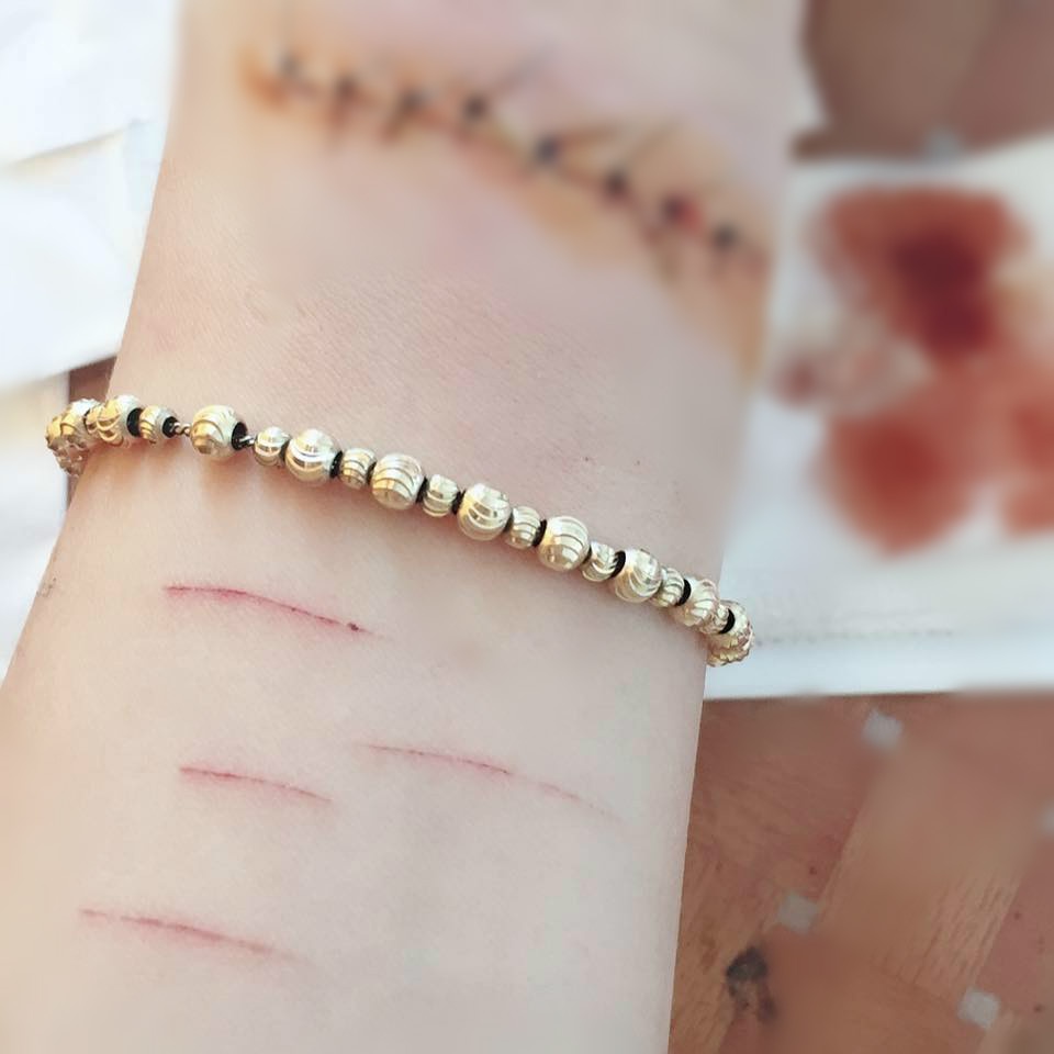 thieu nu rach tay vi ban trai phan boi anh 2