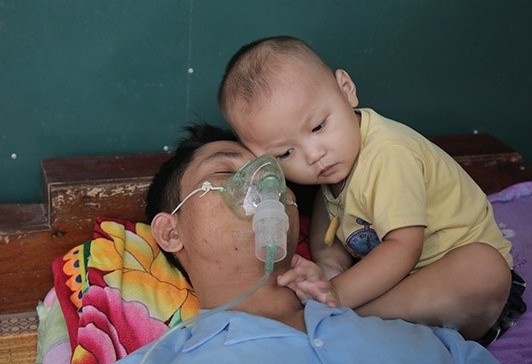Be trai 2 tuoi nep minh vao cha kiet suc vi suy than giai doan cuoi hinh anh