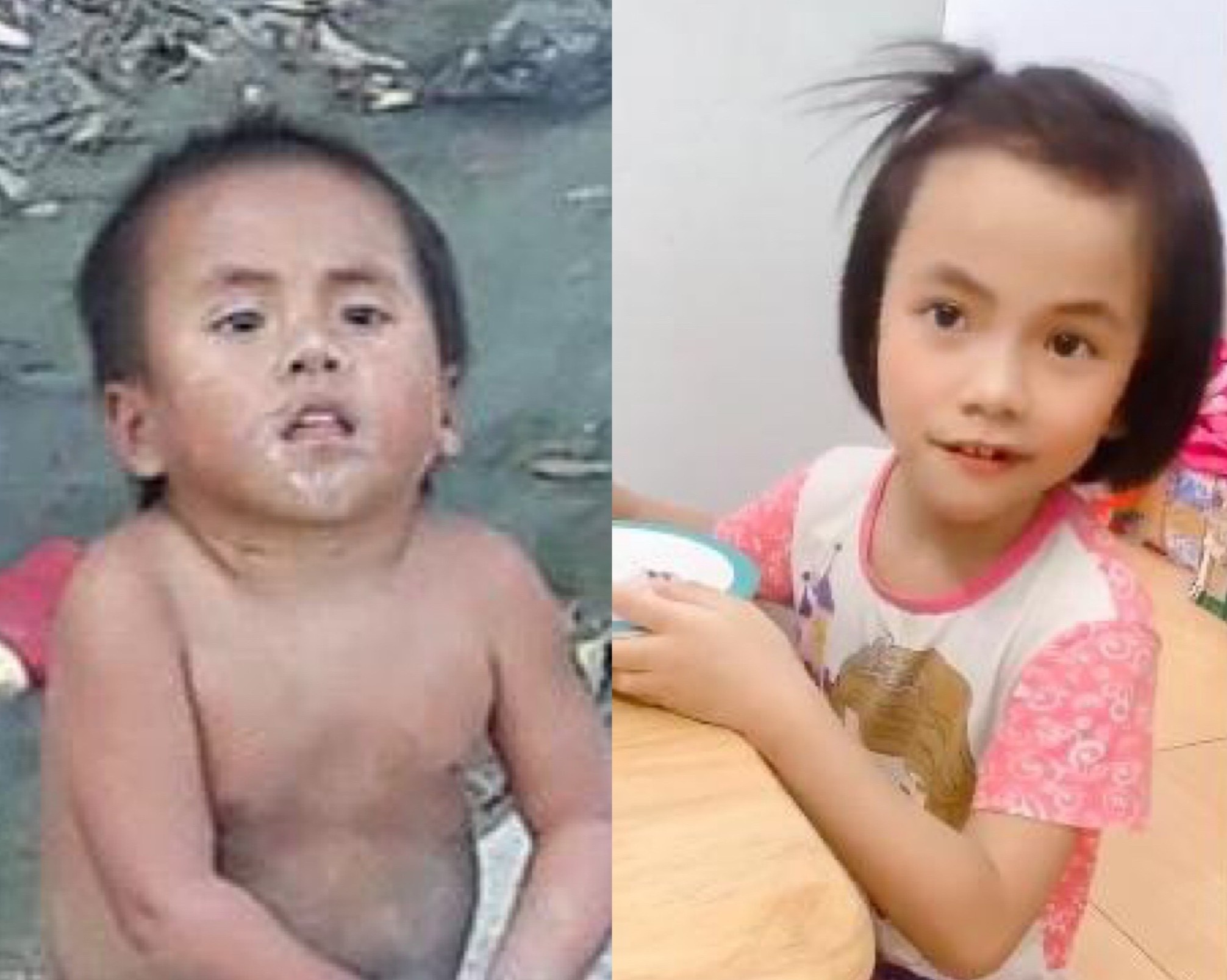 Em be Muong Lat liet 2 chan lon phong phao sau 3 nam duoc nhan nuoi hinh anh