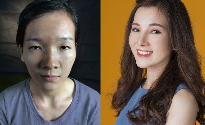 3 sau khi dao kéo của cô gái mắt lươn ảnh 1 3 sau khi dao keo cua co gai mat luon anh 1