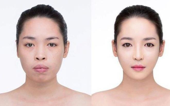 phau thuat tham my anh 4