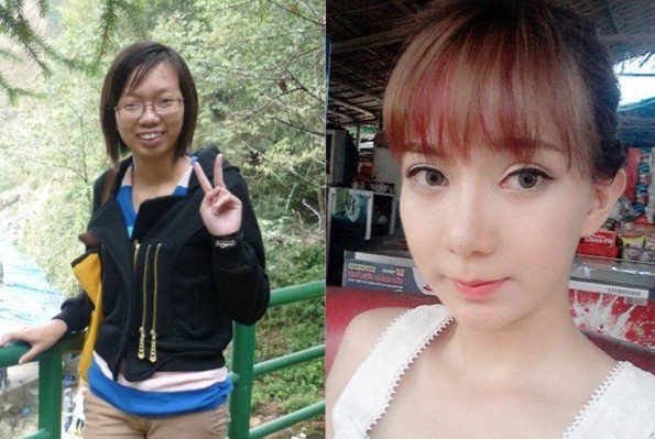 Lay chong, lam nguoi mau, doi doi hoan toan sau khi phau thuat tham my hinh anh