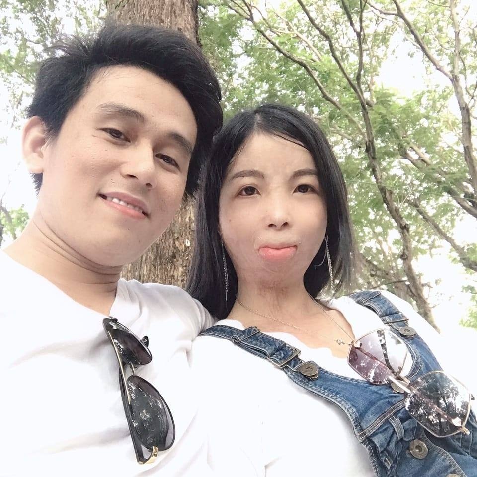 chuyện tình cô gái khuôn mặt biến dạng ảnh 2 chuyen tinh co gai khuon mat bien dang anh 2