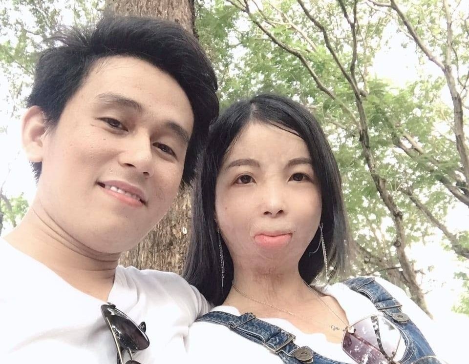 Tinh yeu cua co gai co guong mat bien dang va chang shipper hinh anh