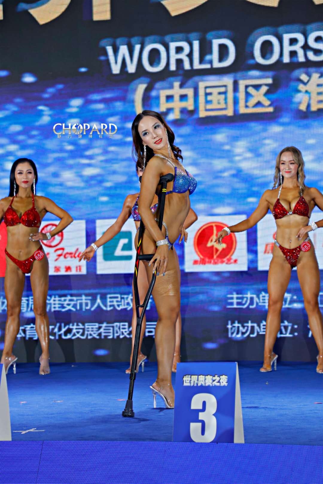 cô gái một chân thi thể hình ảnh 1 co gai mot chan thi the hinh anh 1