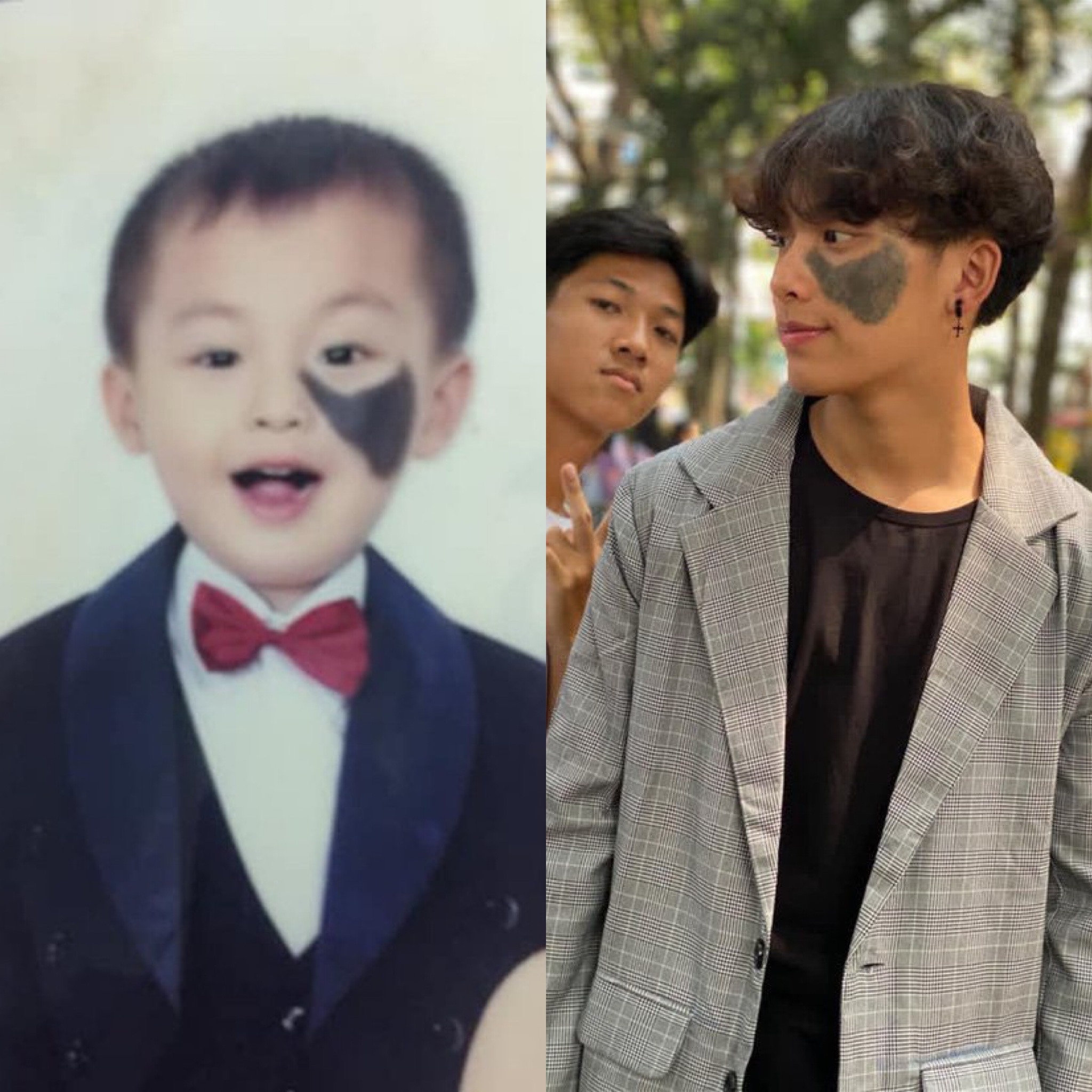 chang trai co vet bot anh 1