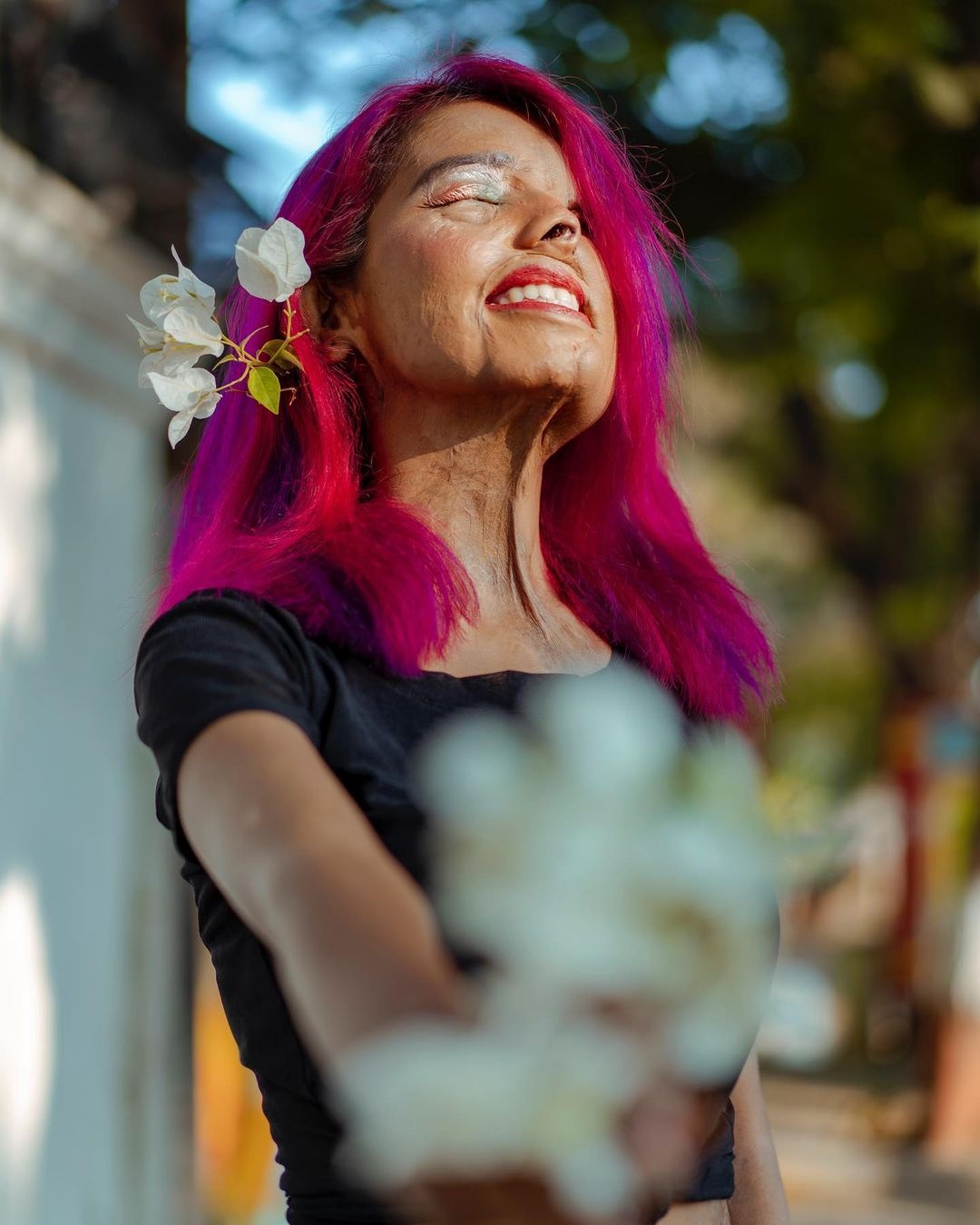 nữ người mẫu bị cha tạt axit ảnh 11 nu nguoi mau bi cha tat axit anh 11