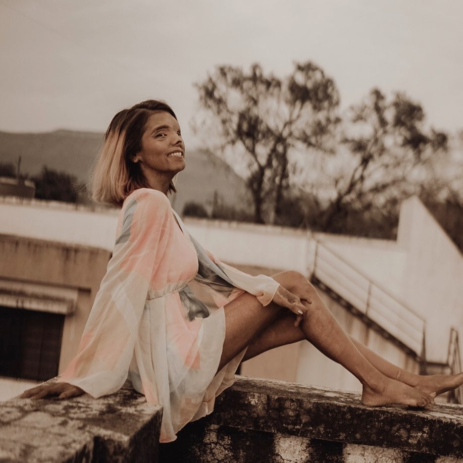 nu nguoi mau bi cha tat axit anh 9