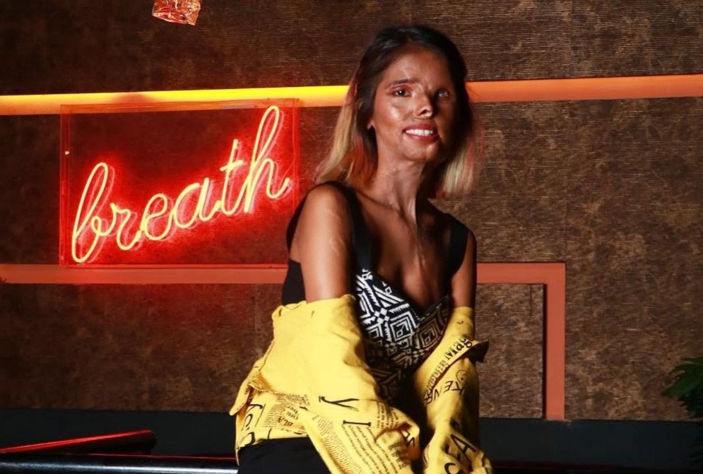 Co gai bi cha ruot tat axit tro thanh nguoi mau hinh anh