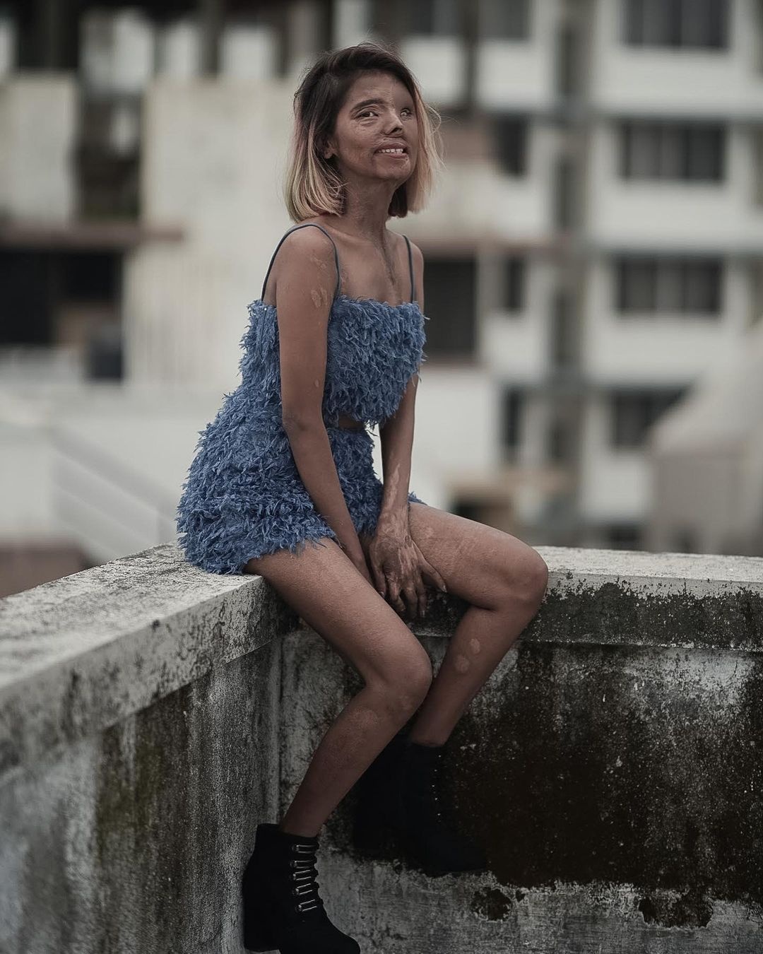 nữ người mẫu bị cha tạt axit ảnh 7 nu nguoi mau bi cha tat axit anh 7