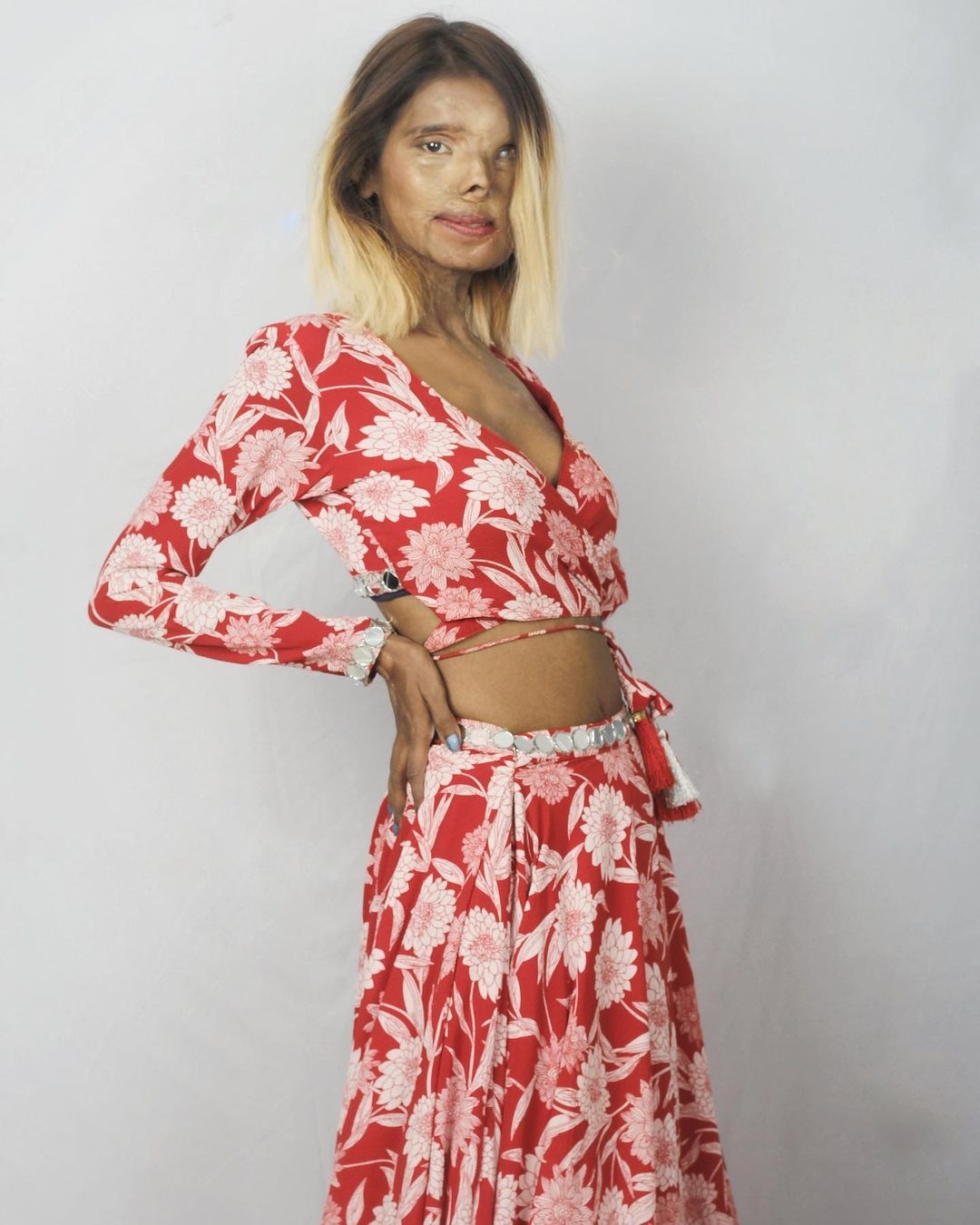 nữ người mẫu bị cha tạt axit ảnh 5 nu nguoi mau bi cha tat axit anh 5