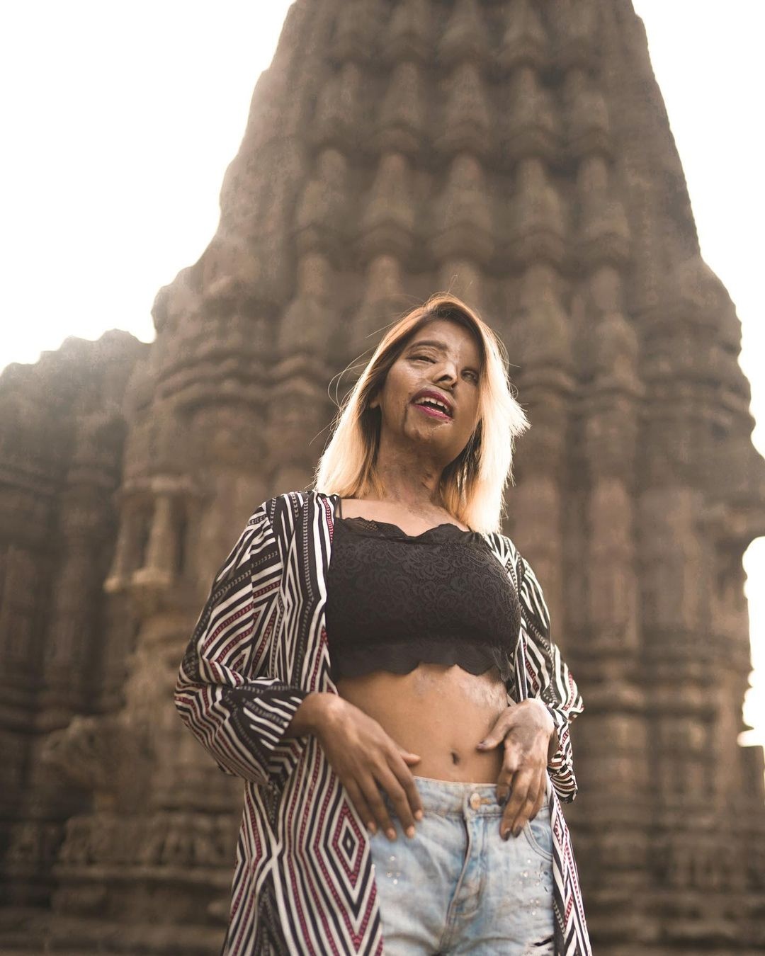 nữ người mẫu bị cha tạt axit ảnh 2 nu nguoi mau bi cha tat axit anh 2