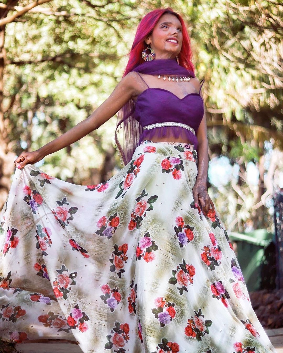 nữ người mẫu bị cha tạt axit ảnh 10 nu nguoi mau bi cha tat axit anh 10