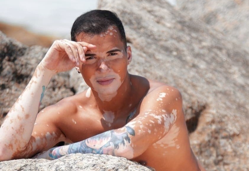 Mau nam tu tin khoe lan da bach bien sau 10 nam che giau hinh anh